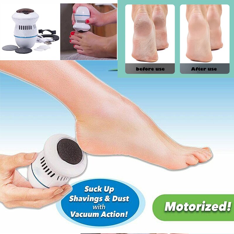 Foot Exfoliating Device with Vacuum