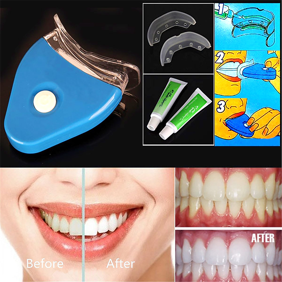 Brighten Your Smile with the Blue LED Teeth Whitening Accelerator - Women's Health & Beauty Must-Have!